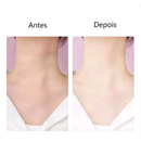 Massageador Facial e de Pescoço com Fototerapia LED - FaceLift Pro